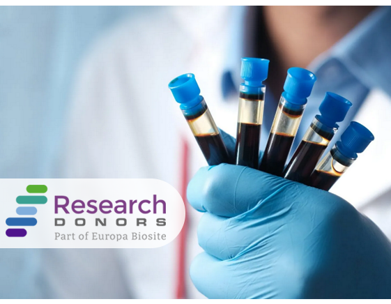 Healthy Blood Biospecimens for Research: Whole Blood, PBMCs, Leukopaks & more