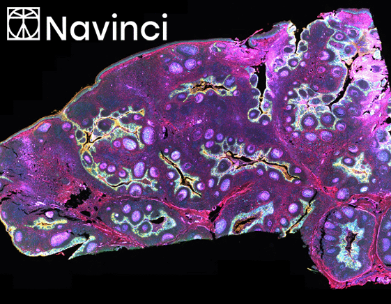 Naveni® Plex Omni Service – The Future of Spatial Interactomics