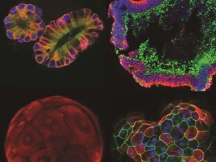 Heartbeat in a Petri Dish: How Organoids Are Revolutionizing Research