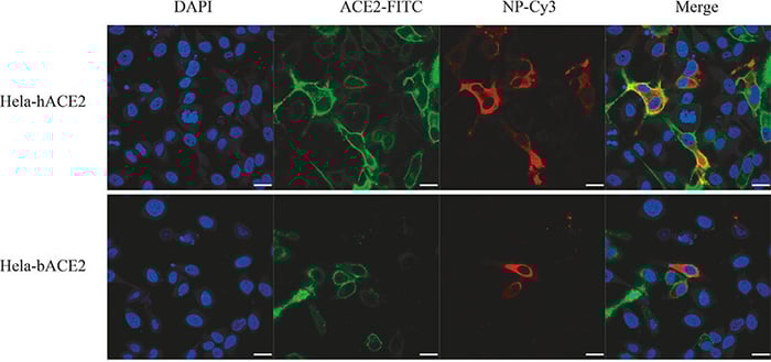 ACE2-Receptor