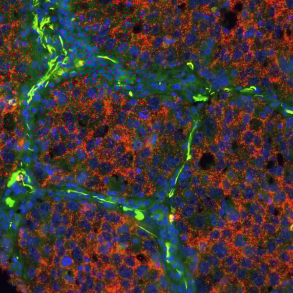 Proximity Ligation: A Revolutionary Protein Detection Technology