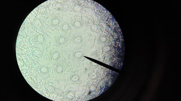 From Microscope to Organelle - the Discovery of the Hemifusome