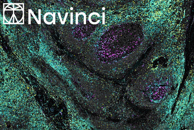 Who with Whom? Visualising Protein Relationships with Naveni® Plex from Navinci