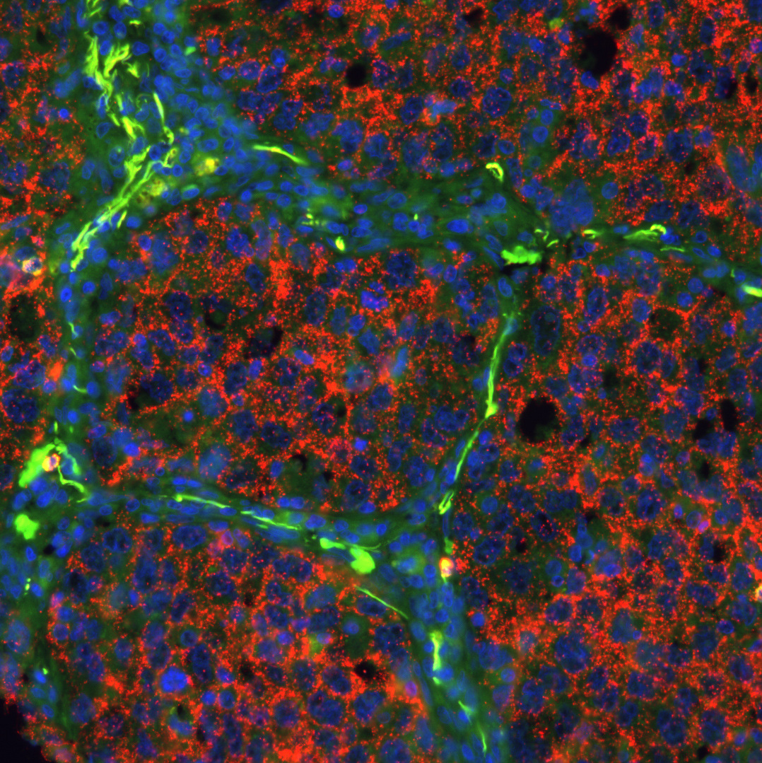 Proximity Ligation: A Revolutionary Protein Detection Technology