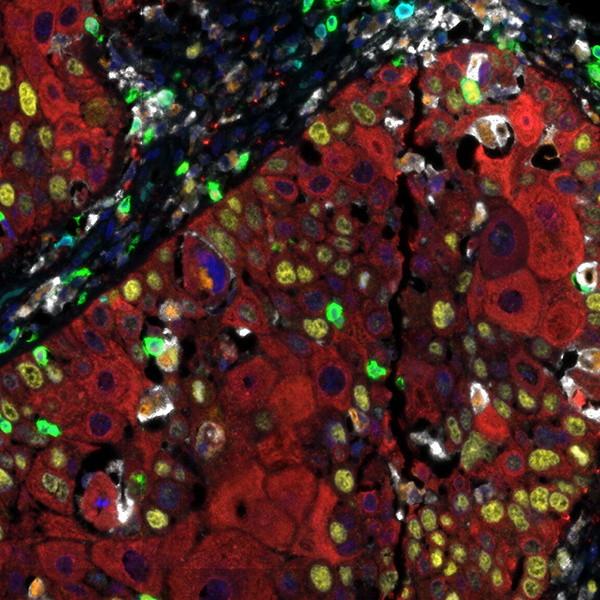 Overview of Multiplex Immunohistochemistry