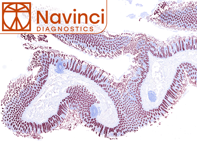 Fully Automated in situ Proximity Ligation Assays from Navinci Diagnostics