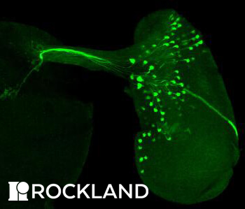 GFP Antibodies - A Comprehensive Guide