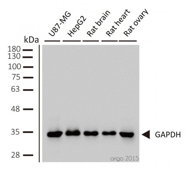 Western Blot Loading Controls