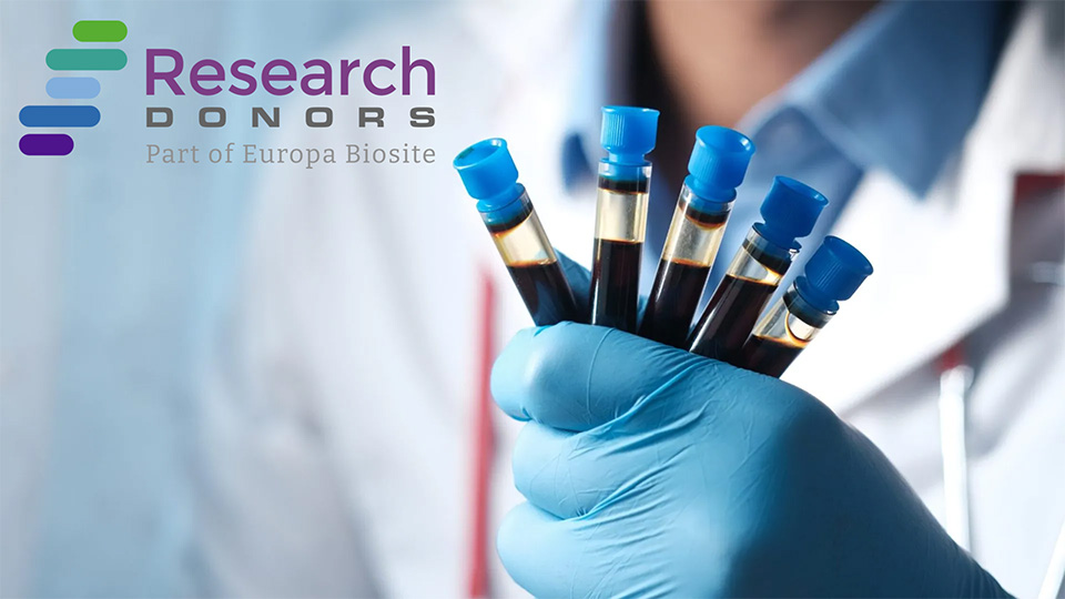 Healthy Blood Biospecimens for Research: Whole Blood, PBMCs, Leukopaks & more