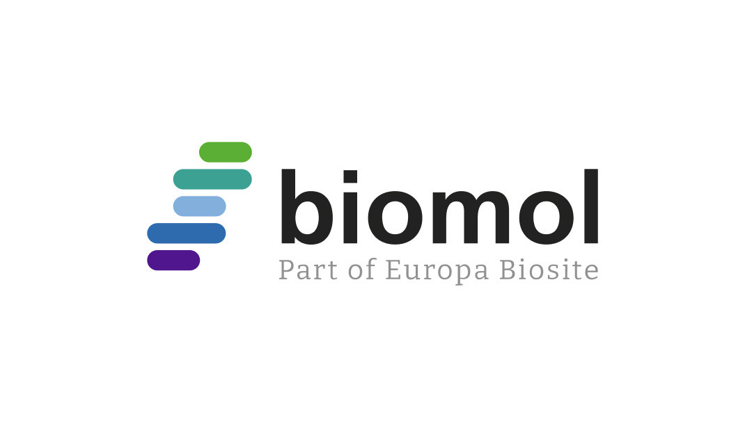 The Tumor Microenvironment - Optimize your T Cell Marker Research with Bethyl Antibodies